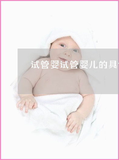 做供卵试管婴儿需要的步骤--做供卵试管婴儿的步骤方法