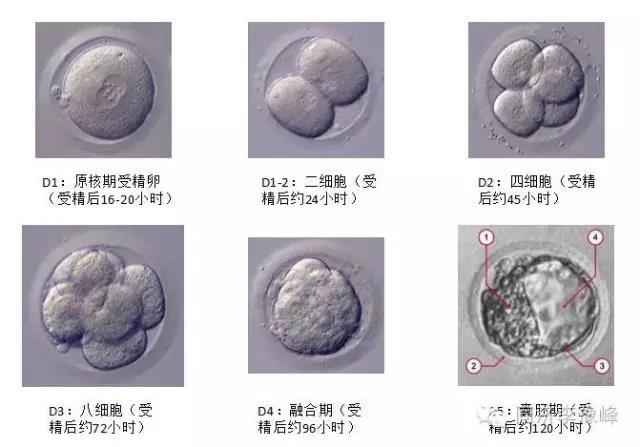 男性供卵试管婴儿的取精时间