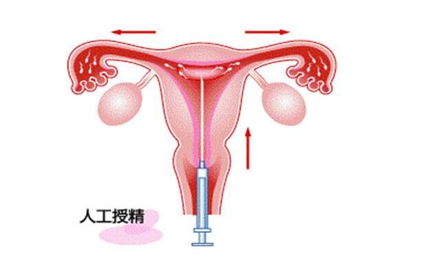 代生宝宝价格胚胎移植后如何正确卧床休息