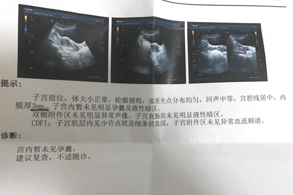 吉林长春做三代有试管代怀成功的吗哪个医院成功率比较高（其实适合自己的才是最好的+）